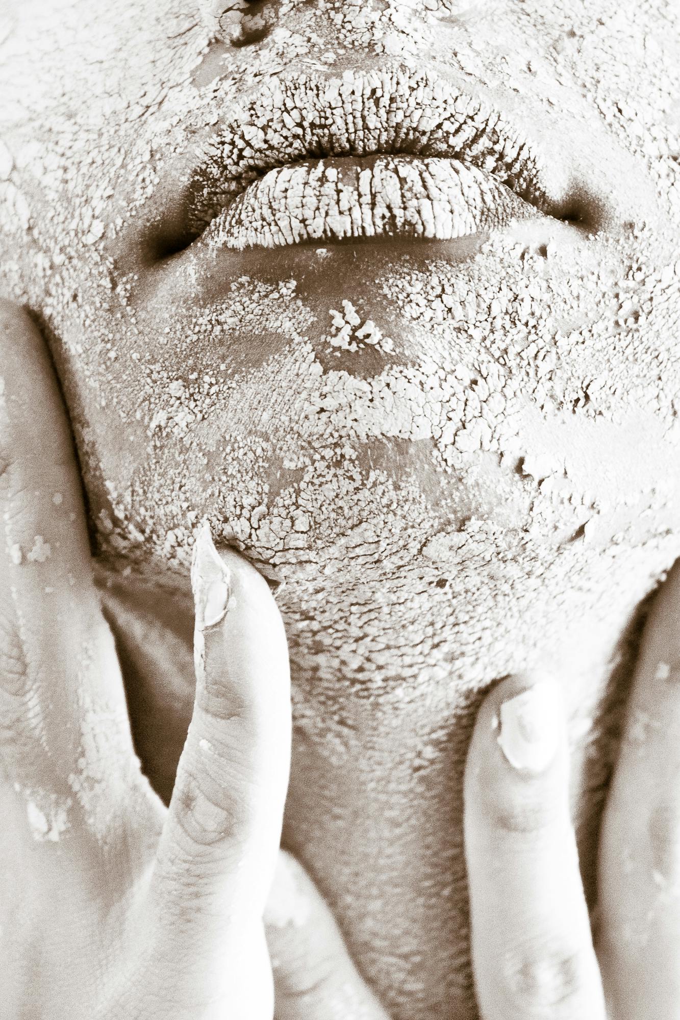 Skin Conditions